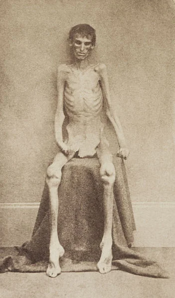 union soldier POW.webp